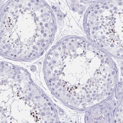 CCDC39 Antibody, Novus Biologicals 0.1mL; Unlabeled:Antibodies, Polyclonal