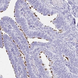 CCDC39 Antibody, Novus Biologicals 0.1mL; Unlabeled:Antibodies, Polyclonal