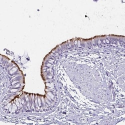CCDC39 Antibody, Novus Biologicals 0.1mL; Unlabeled:Antibodies, Polyclonal