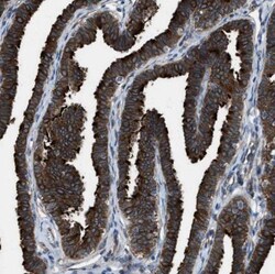 CCDC40 Antibody, Novus Biologicals 0.1mL; Unlabeled:Antibodies, Polyclonal
