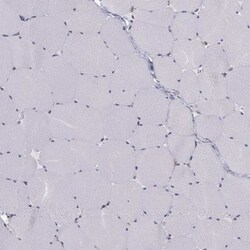 CCDC40 Antibody, Novus Biologicals 0.1mL; Unlabeled:Antibodies, Polyclonal