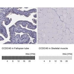 CCDC40 Antibody, Novus Biologicals 0.1mL; Unlabeled:Antibodies, Polyclonal