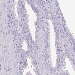 CCDC42B Antibody, Novus Biologicals:Antibodies:Primary Antibodies