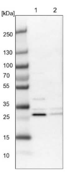 CCDC44 Antibody, Novus Biologicals 25 &mu;L; Unlabeled:Antibodies, Polyclonal