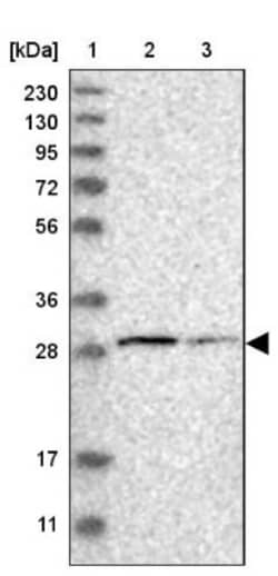 CCDC44 Antibody, Novus Biologicals:Antibodies:Primary Antibodies