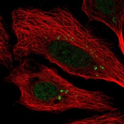 CCDC46 Antibody, Novus Biologicals 0.1mL; Unlabeled:Antibodies, Polyclonal