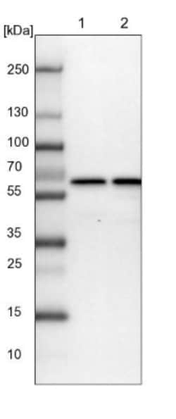 CCDC47 Antibody, Novus Biologicals 0.1mL; Unlabeled:Antibodies, Polyclonal
