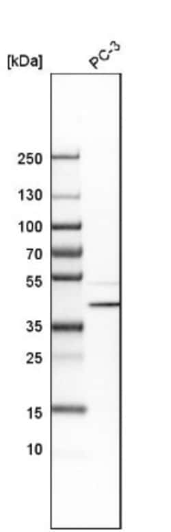 CCDC51 Antibody, Novus Biologicals:Antibodies:Primary Antibodies