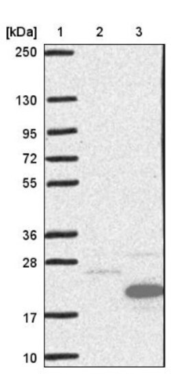 CCDC56 Antibody, Novus Biologicals:Antibodies:Primary Antibodies