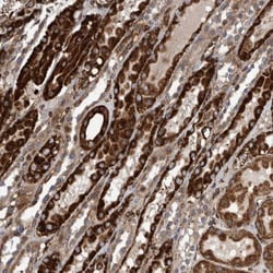 CCDC57 Antibody, Novus Biologicals:Antibodies:Primary Antibodies