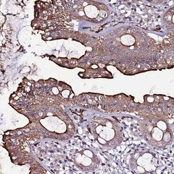 CCDC71 Antibody, Novus Biologicals 0.1mL; Unlabeled:Antibodies, Polyclonal