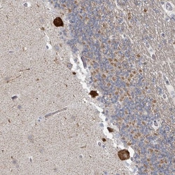 CCDC72 Antibody, Novus Biologicals 25 &mu;L, Unlabeled:Antibodies, Polyclonal