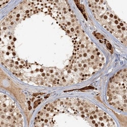 CCDC75 Antibody, Novus Biologicals:Antibodies:Primary Antibodies