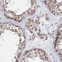 CCDC77 Antibody, Novus Biologicals:Antibodies:Primary Antibodies