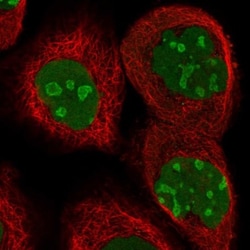 CCDC86 Antibody, Novus Biologicals 25 &mu;L, Unlabeled:Antibodies, Polyclonal