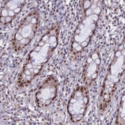 CCDC86 Antibody, Novus Biologicals 25 &mu;L, Unlabeled:Antibodies, Polyclonal