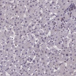 CCDC86 Antibody, Novus Biologicals 25 &mu;L, Unlabeled:Antibodies, Polyclonal