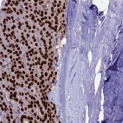 CCDC86 Antibody, Novus Biologicals 25 &mu;L, Unlabeled:Antibodies, Polyclonal