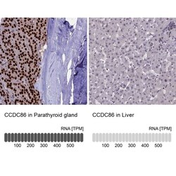 CCDC86 Antibody, Novus Biologicals 25 &mu;L, Unlabeled:Antibodies, Polyclonal