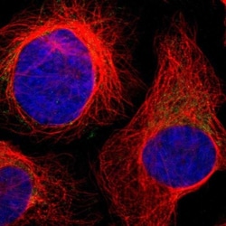 CCDC90B Antibody, Novus Biologicals 25 &mu;L, Unlabeled:Antibodies, Polyclonal