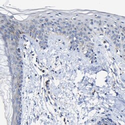 CCDC90B Antibody, Novus Biologicals 25 &mu;L, Unlabeled:Antibodies, Polyclonal