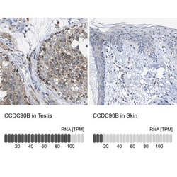 CCDC90B Antibody, Novus Biologicals 25 &mu;L, Unlabeled:Antibodies, Polyclonal