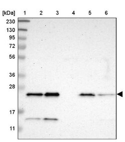 CCDC90B Antibody, Novus Biologicals 25 &mu;L, Unlabeled:Antibodies, Polyclonal