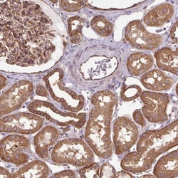 CCDC93 Antibody, Novus Biologicals:Antibodies:Primary Antibodies