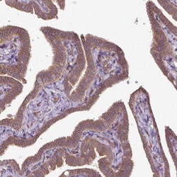 CCDC93 Antibody, Novus Biologicals:Antibodies:Primary Antibodies