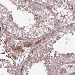 CCDC93 Antibody, Novus Biologicals:Antibodies:Primary Antibodies