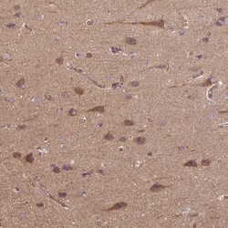CCDC93 Antibody, Novus Biologicals:Antibodies:Primary Antibodies