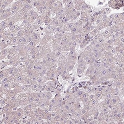 CCDC93 Antibody, Novus Biologicals:Antibodies:Primary Antibodies