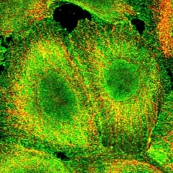 CCDC97 Antibody, Novus Biologicals:Antibodies:Primary Antibodies