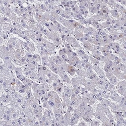 CCDC97 Antibody, Novus Biologicals 0.1mL; Unlabeled:Antibodies, Polyclonal