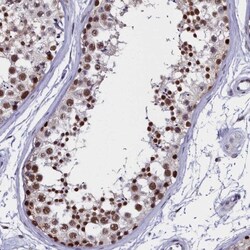 CCDC97 Antibody, Novus Biologicals 0.1mL; Unlabeled:Antibodies, Polyclonal