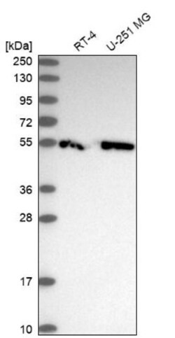 CCDC97 Antibody, Novus Biologicals 0.1mL; Unlabeled:Antibodies, Polyclonal