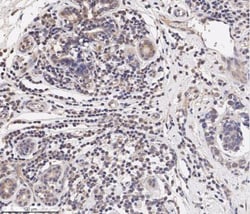 CCL2/MCP1 Antibody - BSA Free, Novus Biologicals 0.1mL; Unlabeled:Antibodies,