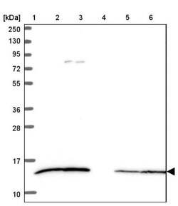 CCL21/6Ckine Antibody, Novus Biologicals 0.1mL; Unlabeled:Antibodies, Polyclonal