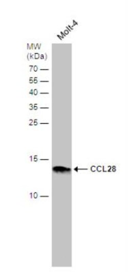 CCL28 Antibody, Novus Biologicals 0.1mL; Unlabeled:Antibodies, Polyclonal