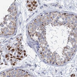 CCP110 Antibody, Novus Biologicals 0.1mL; Unlabeled:Antibodies, Polyclonal