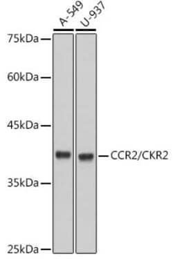 CCR2 Rabbit anti-Human, Mouse, Rat, Clone: 10L1L6, Novus Biologicals:Antibodies:Primary