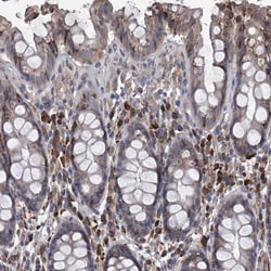 CCR4 Antibody, Novus Biologicals 25 &mu;L; Unlabeled:Antibodies, Polyclonal