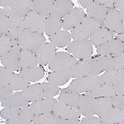 CCR4 Antibody, Novus Biologicals 25 &mu;L; Unlabeled:Antibodies, Polyclonal