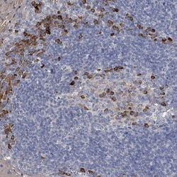 CCR4 Antibody, Novus Biologicals 25 &mu;L; Unlabeled:Antibodies, Polyclonal