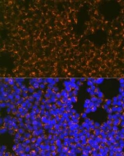CCR8 Rabbit anti-Human, Mouse, Clone: 9N1Y1, Novus Biologicals:Antibodies:Primary