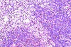 CCR8 Antibody, Novus Biologicals 0.1 mg; Unconjugated:Antibodies, Polyclonal