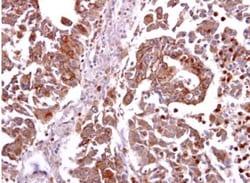CCR8 Antibody, Novus Biologicals 0.1mL; Unlabeled:Antibodies, Polyclonal