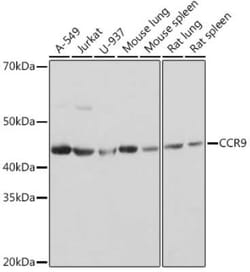 CCR9 Rabbit anti-Human, Mouse, Rat, Clone: 4F7Q6, Novus Biologicals 100