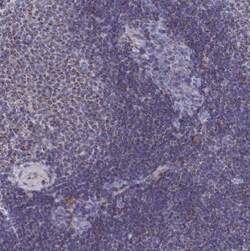 CCRL2/CRAM-A/B Antibody, Novus Biologicals:Antibodies:Primary Antibodies