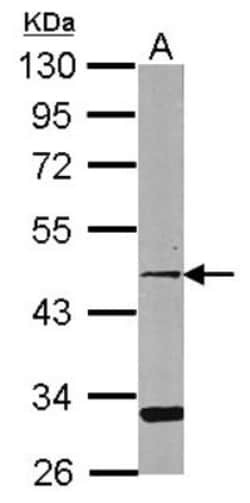 CCRL2/CRAM-A/B Antibody, Novus Biologicals 0.1mL; Unlabeled:Antibodies,